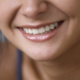 Aesthetische_Zahnmedizin-280x280.jpg